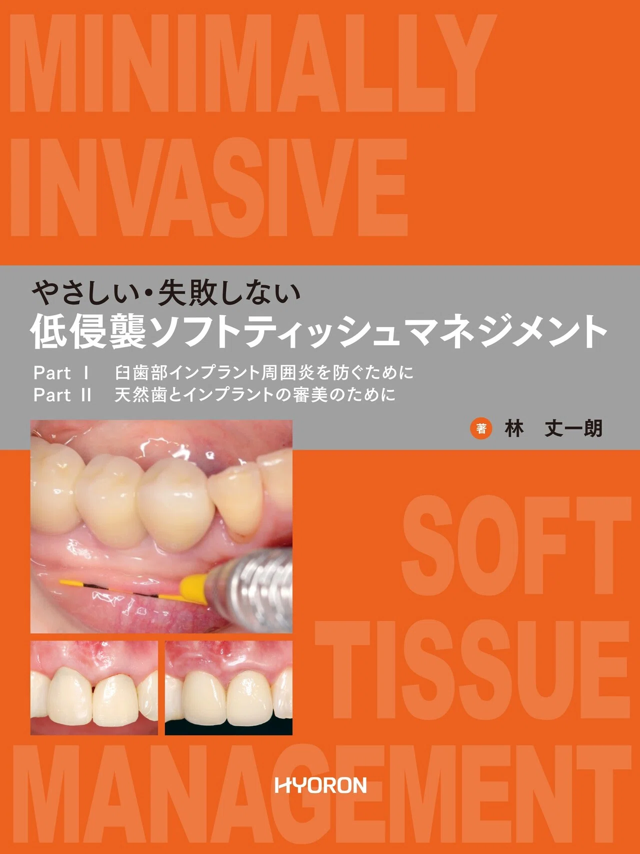 日本歯科評論の“歯周治療”特集（書籍・雑誌）｜月刊『日本歯科評論