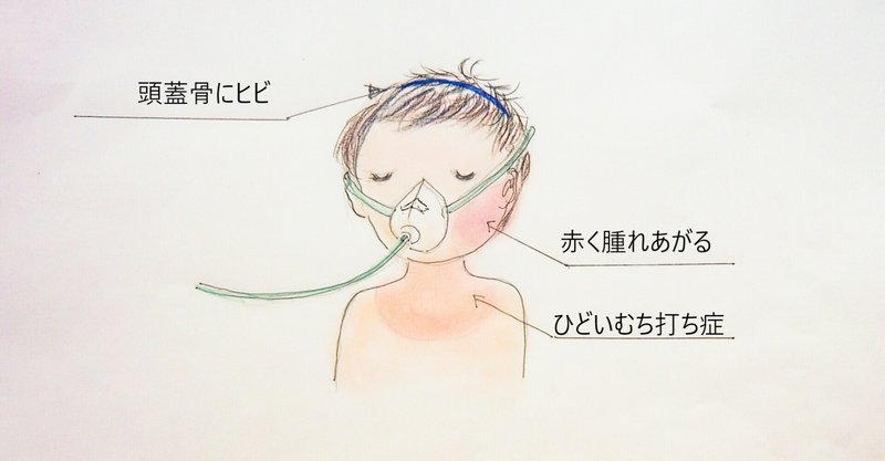 頭蓋骨にヒビ の新着タグ記事一覧 Note つくる つながる とどける