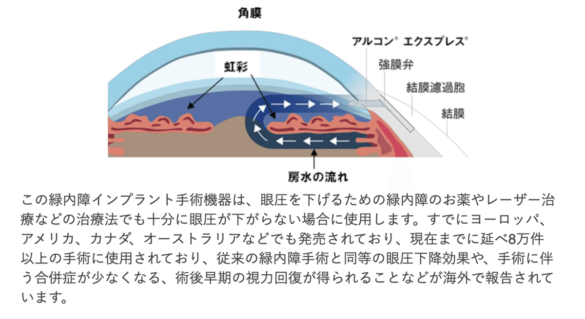 スクリーンショット 2021-11-24 22.59.18