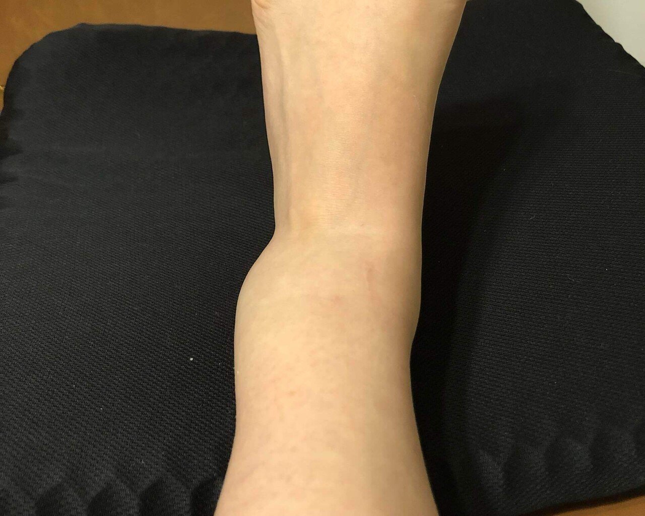 腓骨骨折日記 関美希奈 Note 腓骨骨折日記 関美希奈 Note