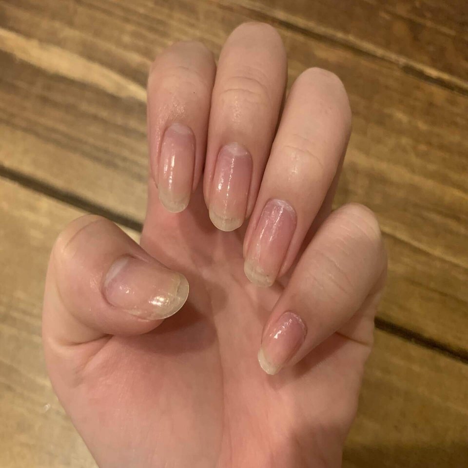 深爪がコンプレックスで人前で爪を見せるのが怖かった私が 人に爪を褒められるようになるまで さいとうはな Note