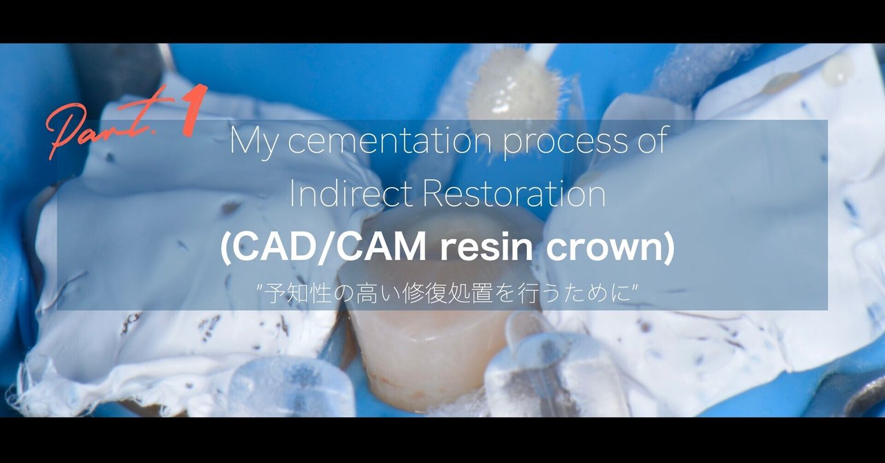 My cementation process of Indirect Restoration (CAD/CAM resin crown ...