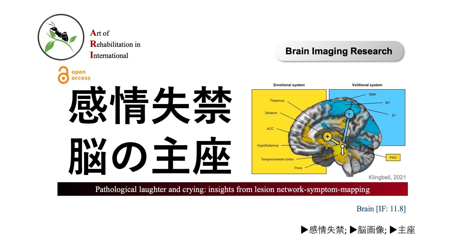 感情失禁・脳の主座｜Super Human | 理学療法士／保健学博士 Ph.D.