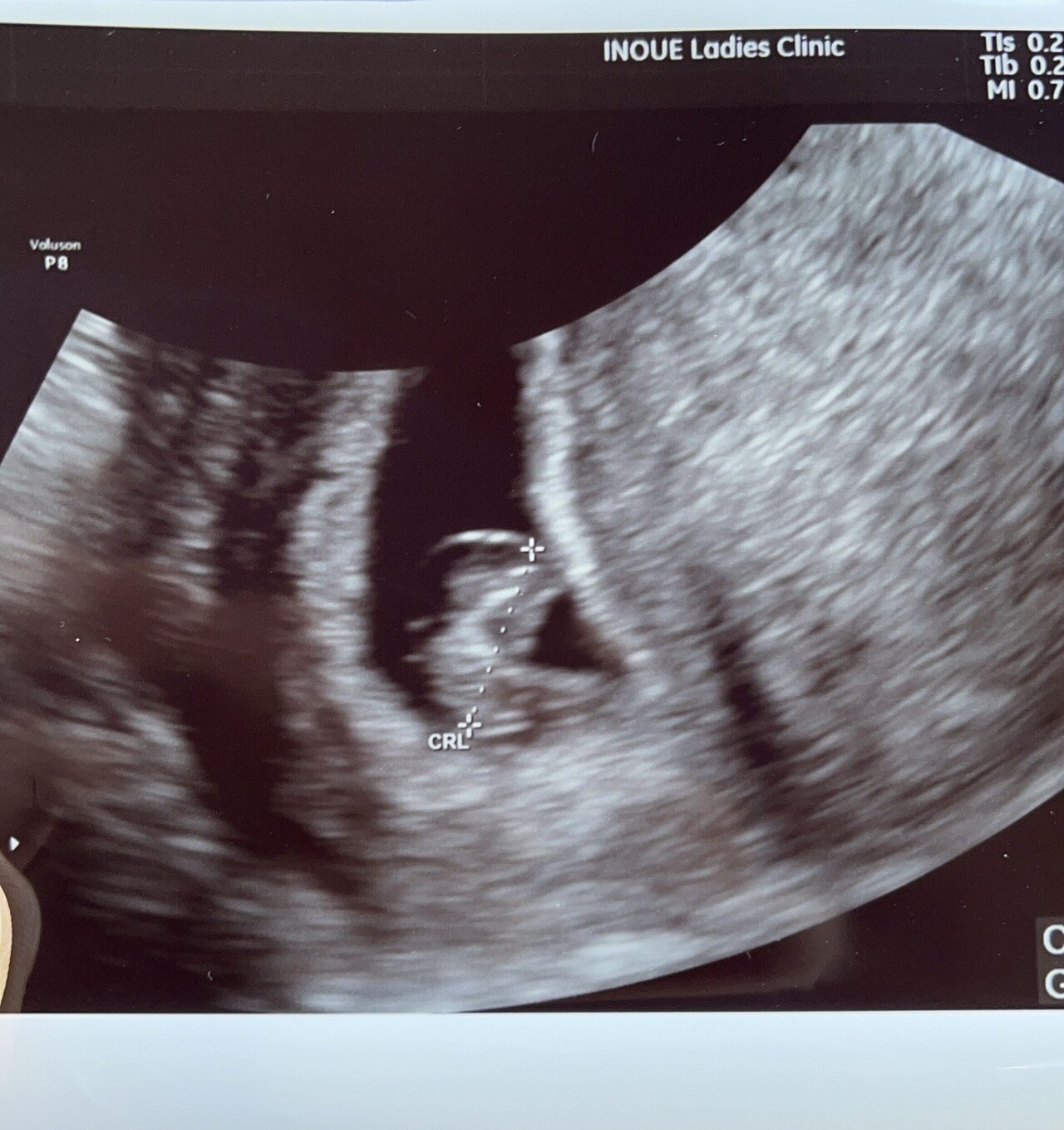 不妊治療のはなし23 田中 令 Umum Note 不妊治療のはなし23 田中 令 Umum Note