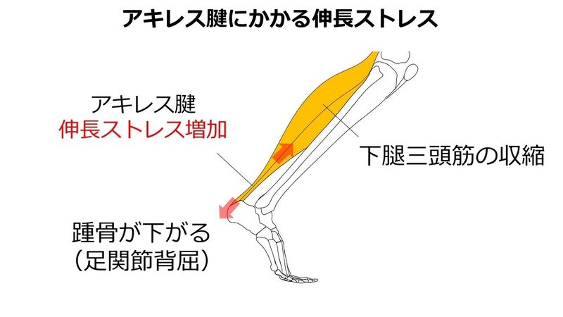 伸長ストレス