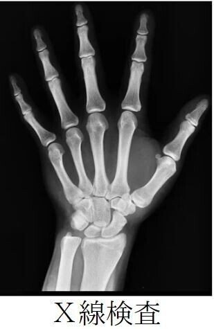 X線検査