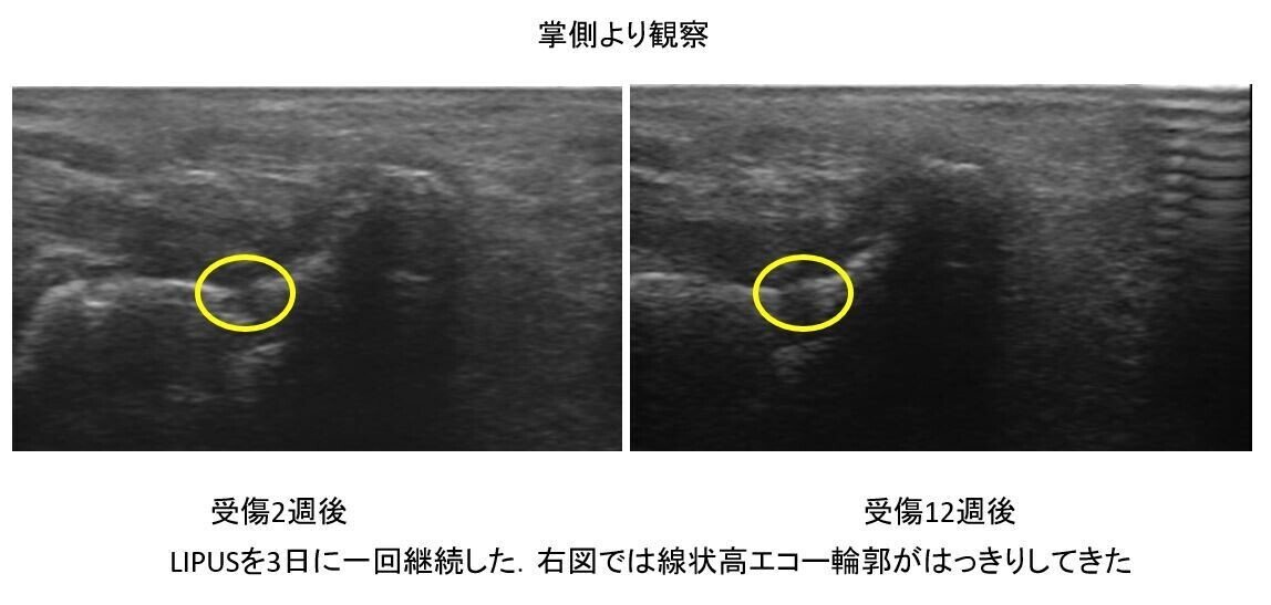 掌側より観察 川島