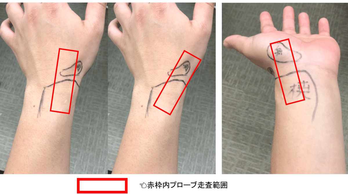 プローブ走査範囲
