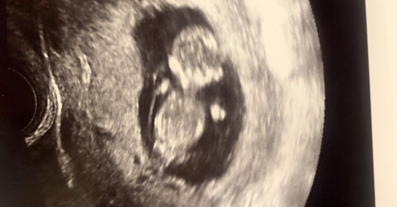 妊娠四ヶ月 の新着タグ記事一覧 Note つくる つながる とどける