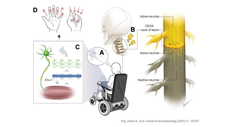 2【Journal of neurophysiology】Ting, 2021：スリーブアレイを用いた四肢麻痺者の動作試行時の麻痺筋への神経駆動のセンシングとデコード_サムネイル