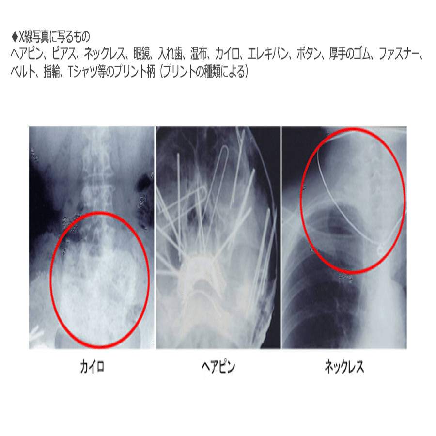 失敗談 カイロ貼ったまま胸写 林やすひろ Note