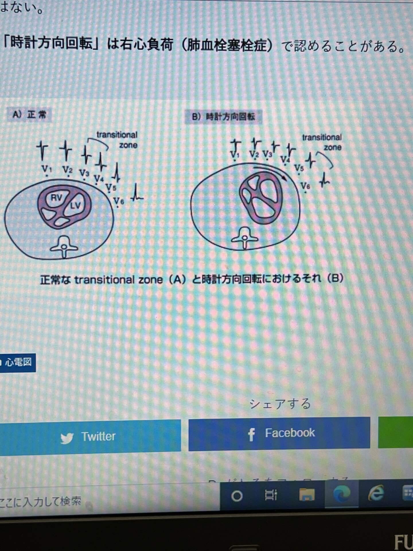 心電図 時計回転 反時計回転について Daiki Kento Note