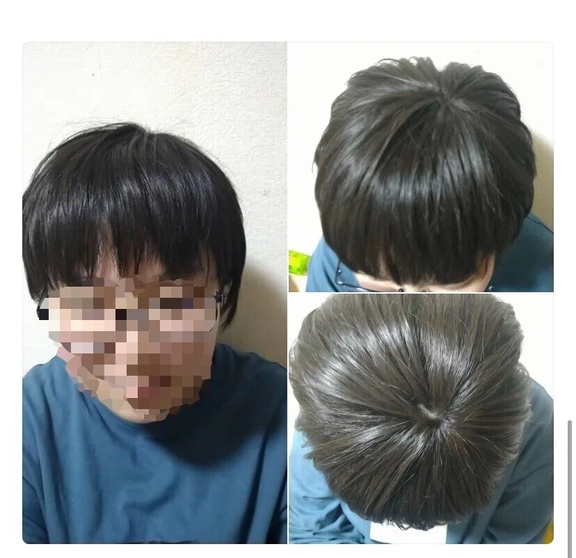 ⑥✨✨部分ウィッグ✨✨自分の髪を出すタイプ 弱けれ