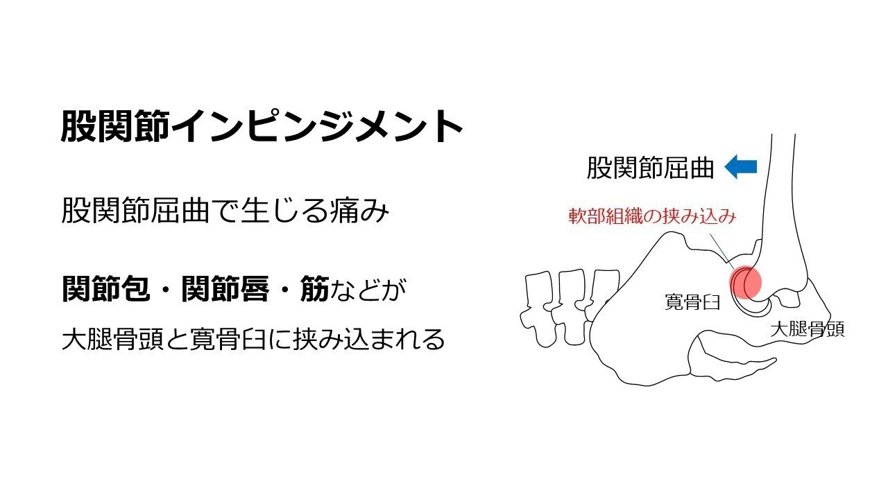 股関節インピンジメントに対するアプローチ L Fit Note 股関節インピンジメントに対するアプローチ L Fit Note