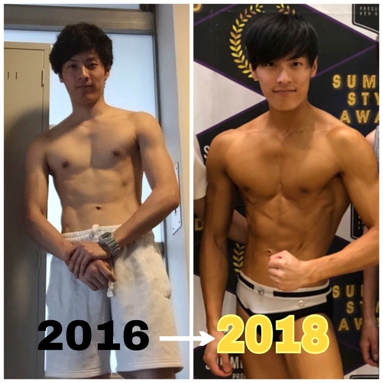 漏斗胸との闘い 手術を辞めた理由 Zu Na Note