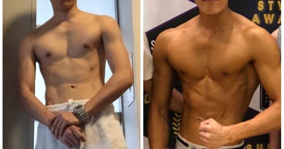 漏斗胸との闘い 手術を辞めた理由 Zu Na Note