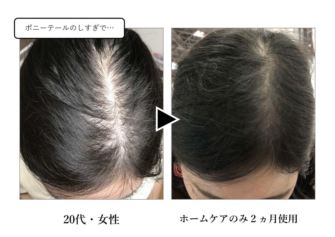 ヘアーアディクト 育毛剤 ヘアアディクト アイヘアーセラム ヘアーアディクト 育毛剤 ヘアアディクト アイヘアーセラム