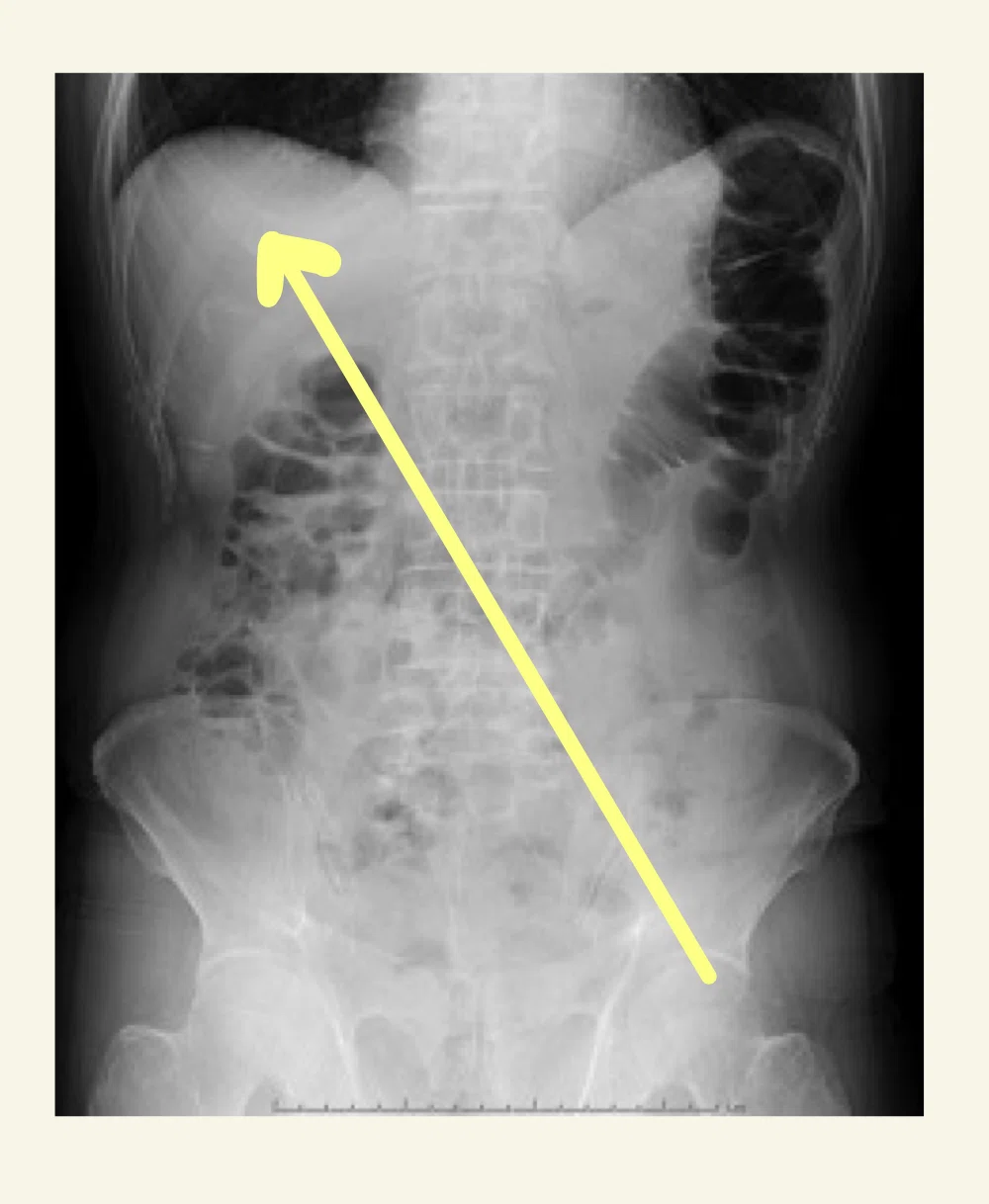 腹部血管のX線解剖図譜 解剖学】腹部解剖の本質を理解する②｜ねこのて