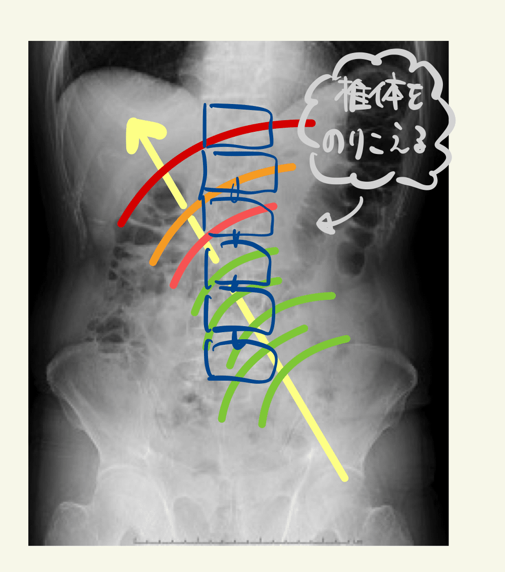 解剖学】腹部解剖の本質を理解する②|ねこのて 解剖学】腹部解剖の本質を理解する②|ねこのて