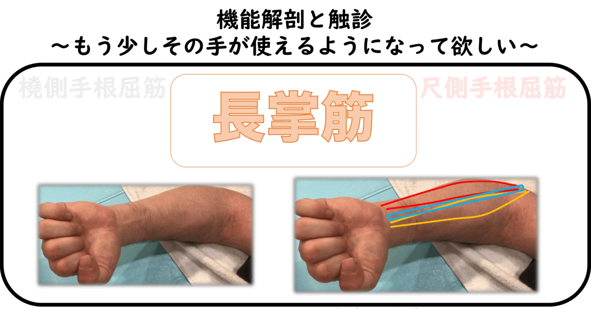 ハンドセラピー 上肢の機能解剖と触診 機能解剖と触診〜長掌筋〜セミナー動画〜VIP会員無料〜「1話無料公開