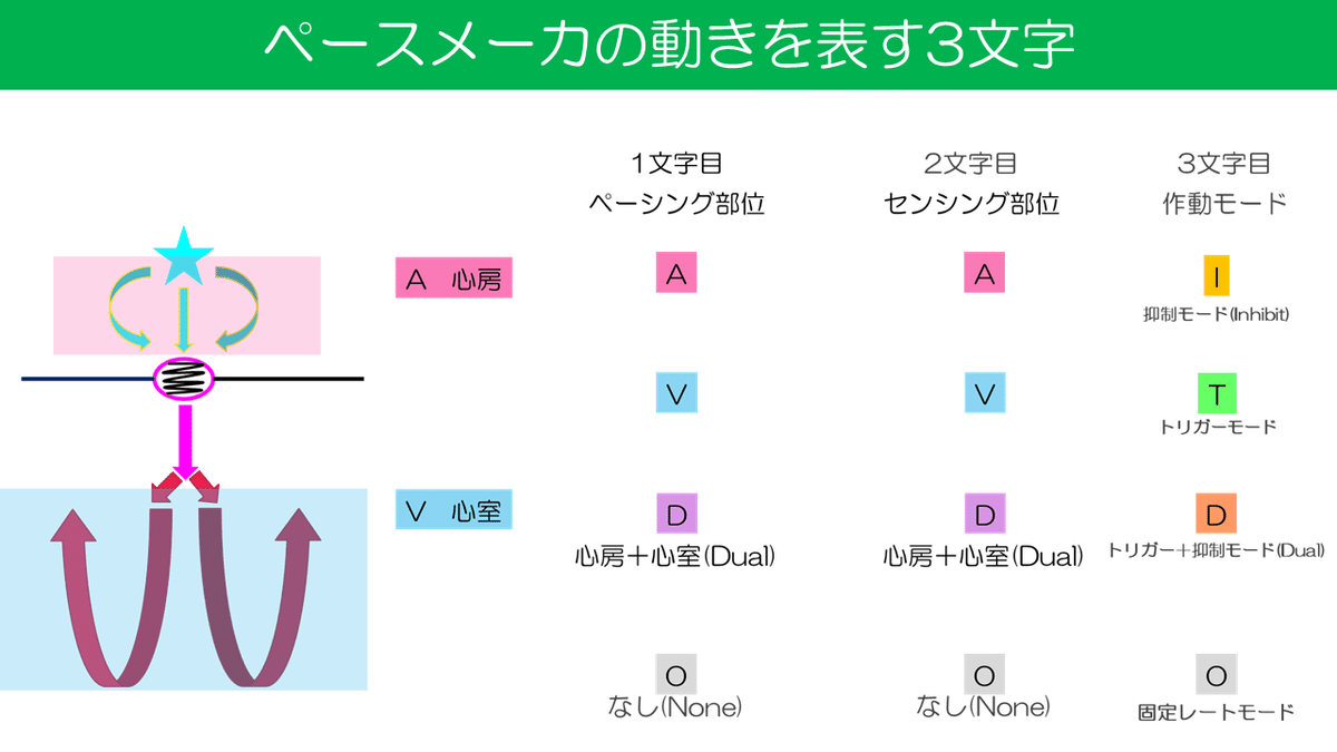 ペースメーカの動きを表す3文字