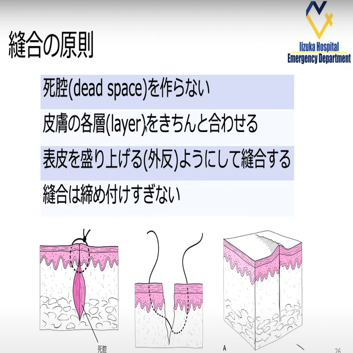 ERでの創処置 縫合・治療のスタンダード 原著第4版 | Alexander