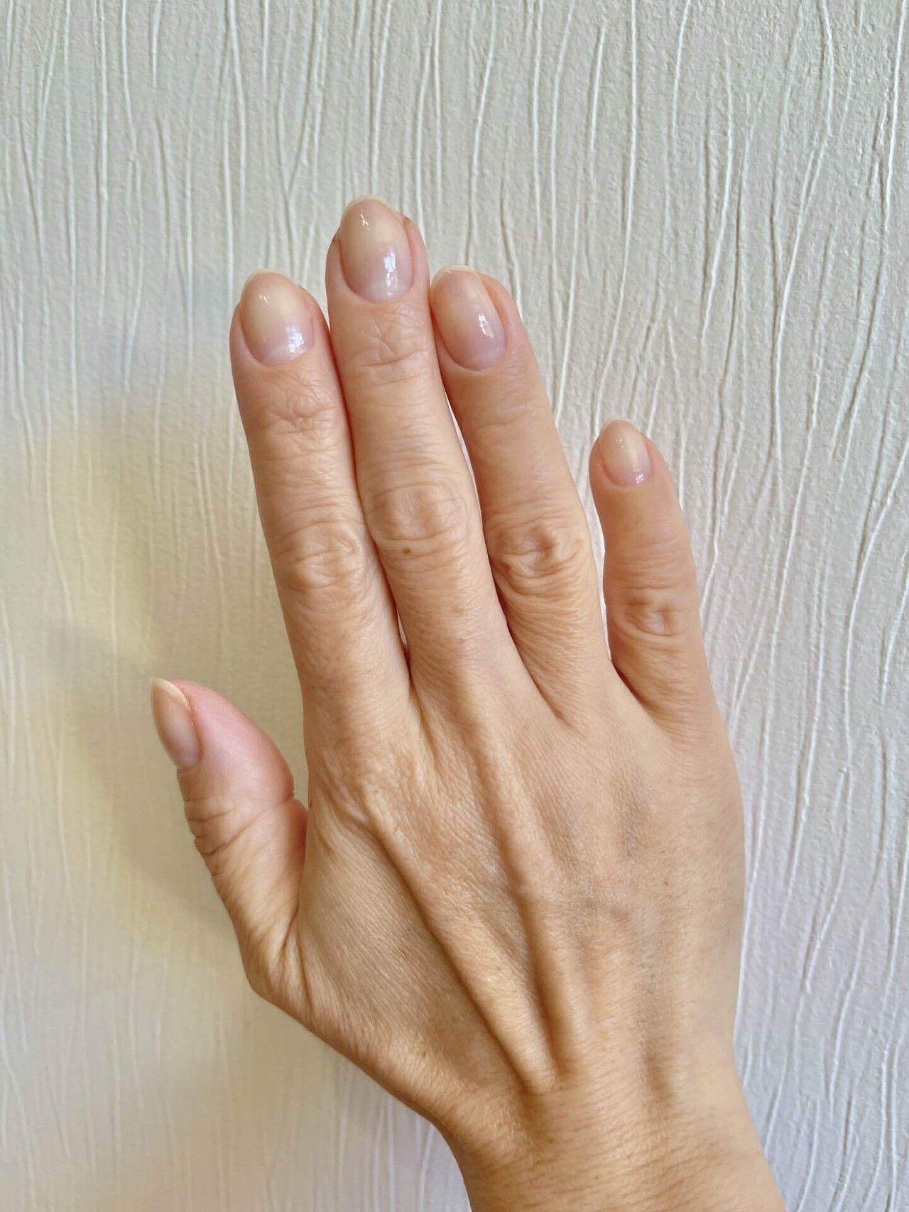 目で見る人間の自然治癒力 Atsu Note