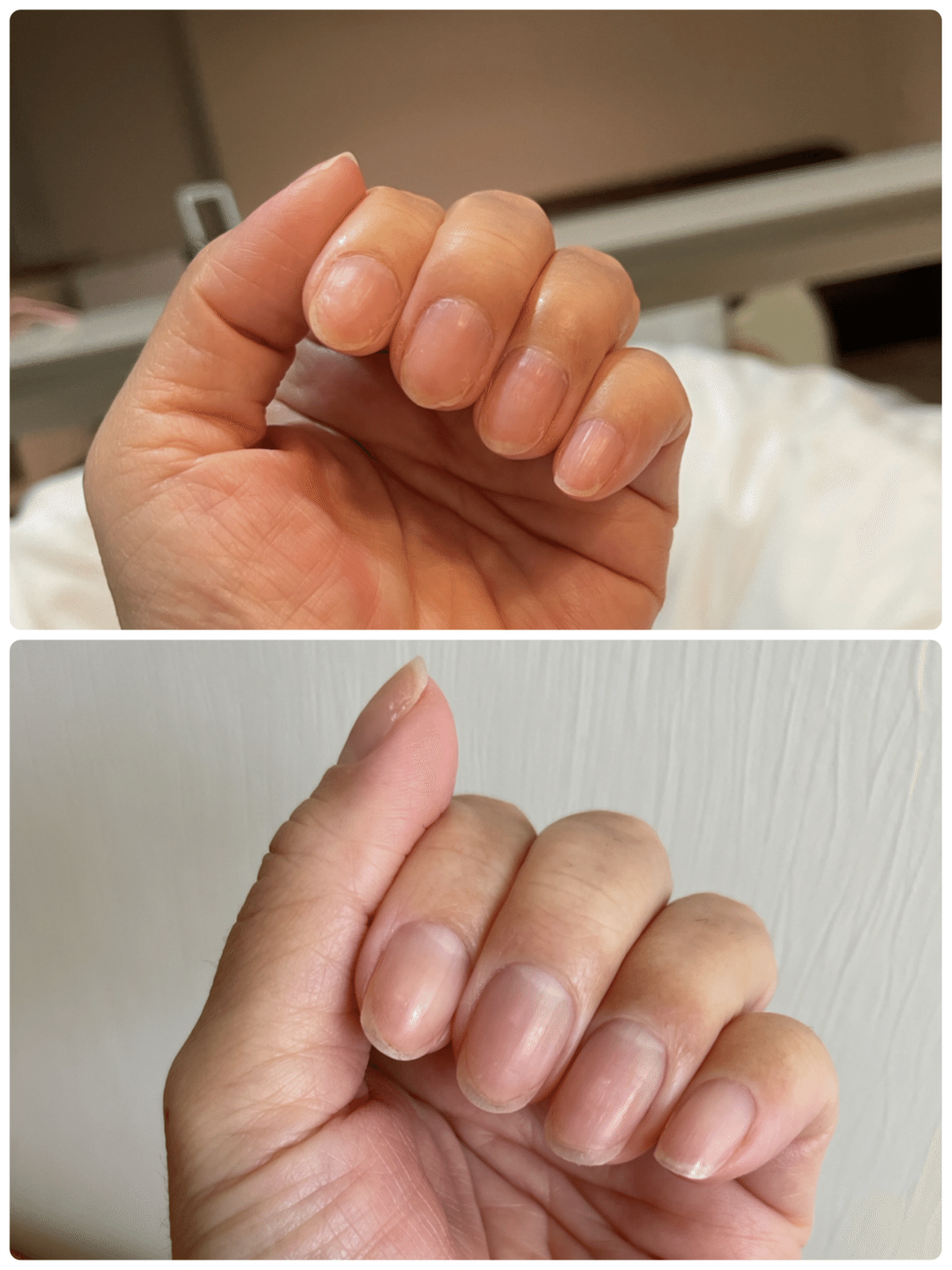 目で見る人間の自然治癒力 Atsu Note