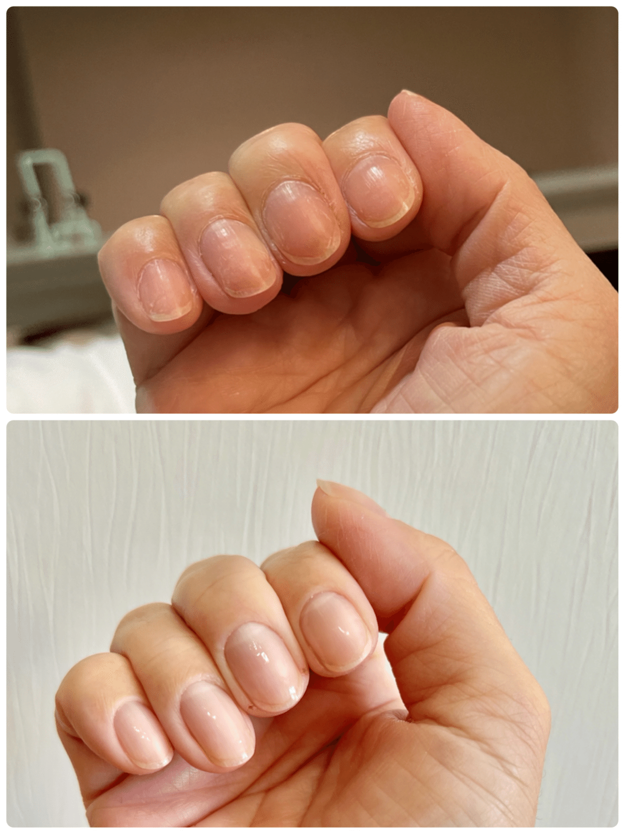 目で見る人間の自然治癒力 Atsu Note