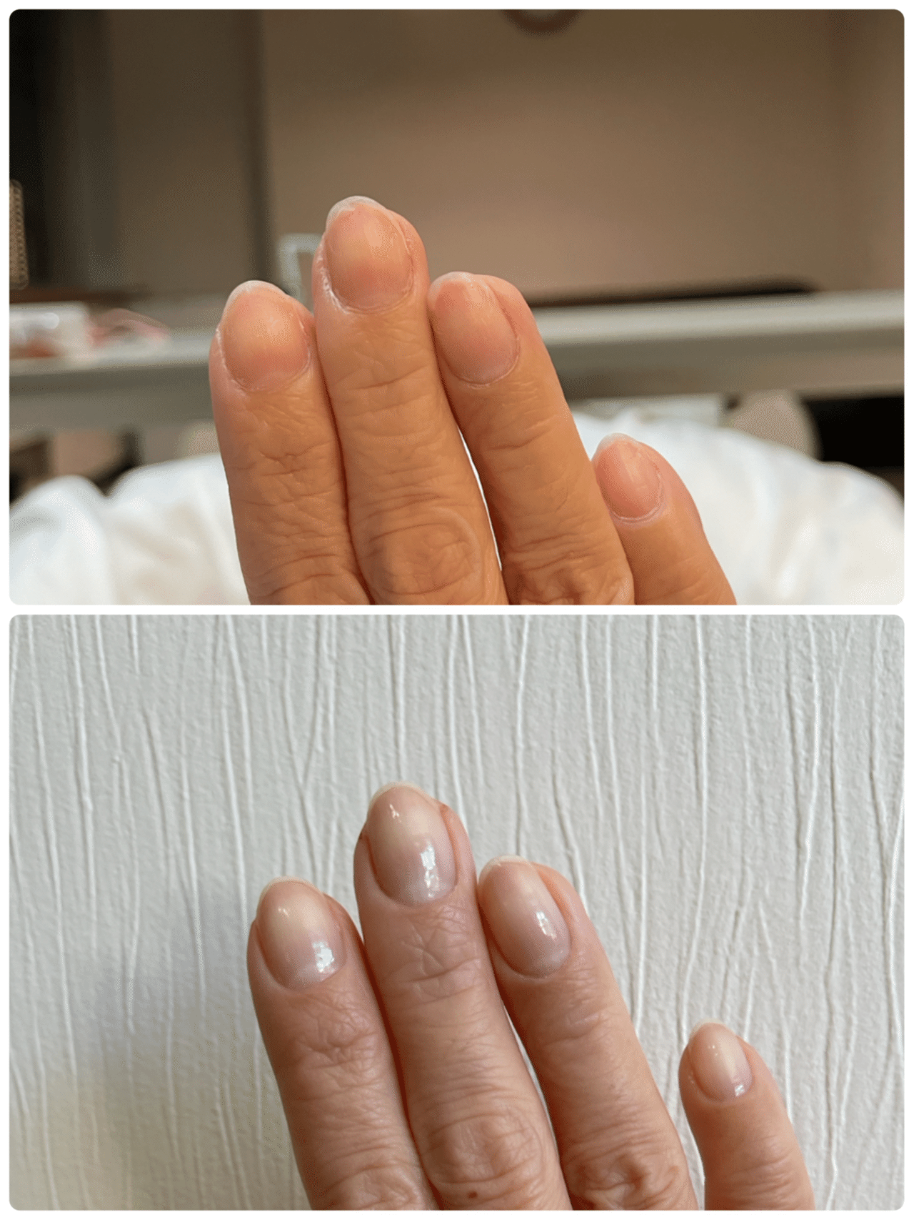 目で見る人間の自然治癒力 Atsu Note