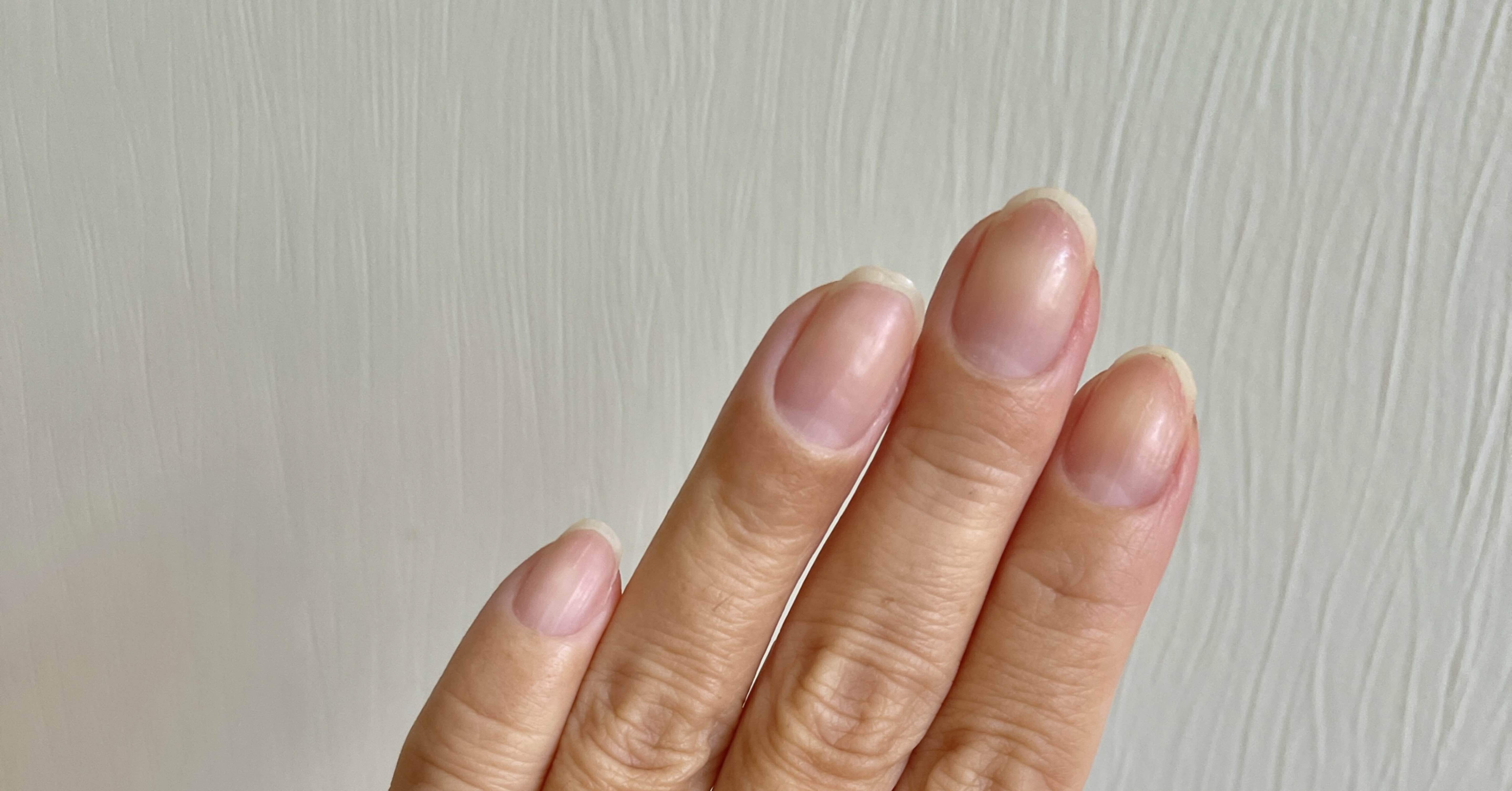 目で見る人間の自然治癒力 Atsu Note