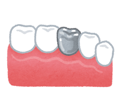 銀歯　歯
