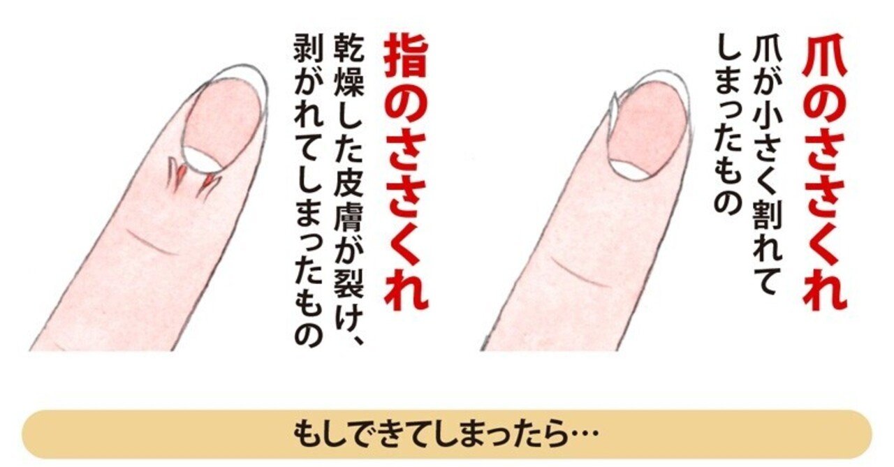 指のささくれ Incodesa Com Co 指のささくれ Incodesa Com Co
