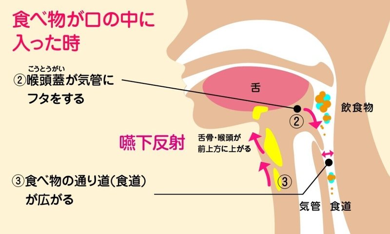 食道に食べ物がある