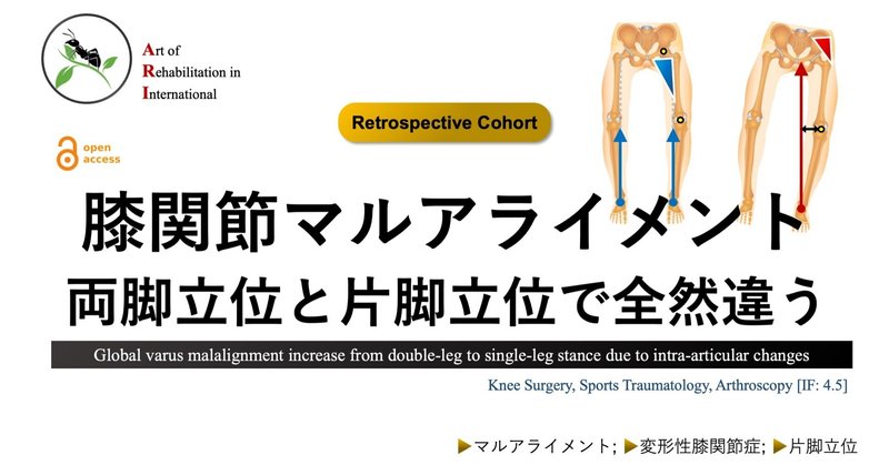 膝関節マルアライメント。両脚立位と片脚立位で全然違う