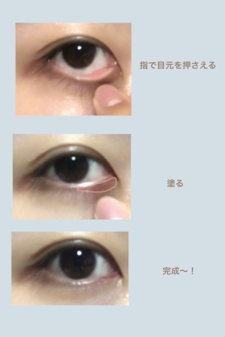 切開ライン考察 まぶみ Note