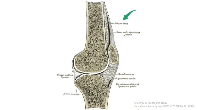 パテラセッティング (3)