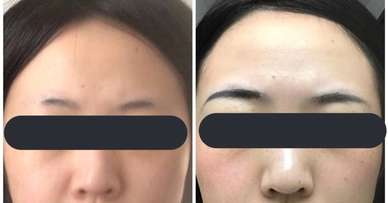 おブス必見 300万整形の裏側全部暴露 整形して可愛くなりたい女子へ 後編 隠遁人妻 Note