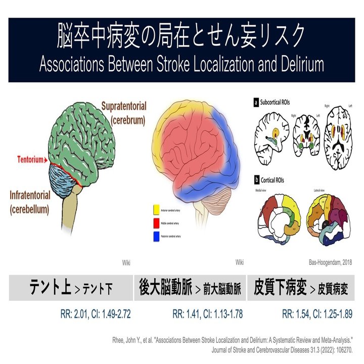 せん妄の脳主座。｜Super Human | 理学療法士／保健学博士 Ph.D.