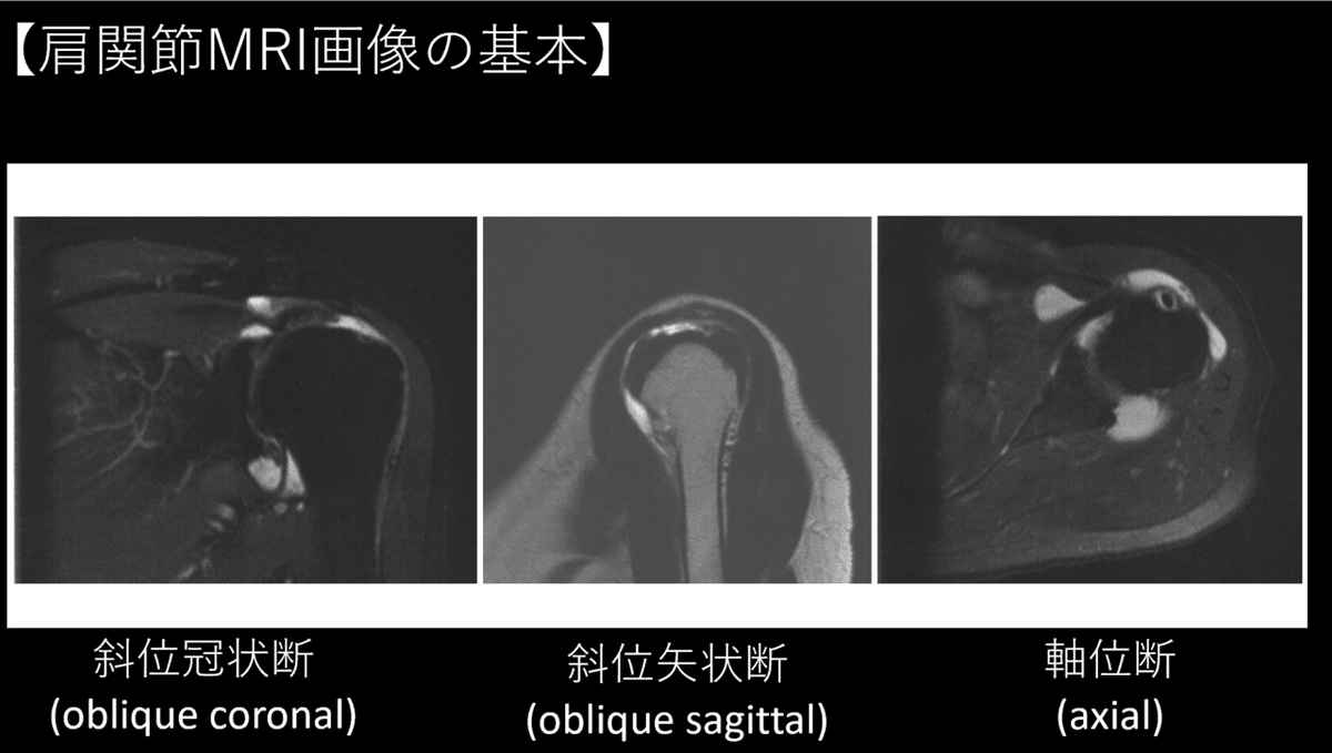 肩関節におけるMRI画像の見かた｜Asumi.Kumada