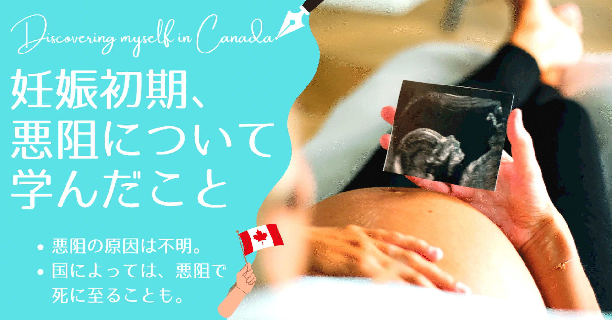 妊娠初期 悪阻について 学んだこと Nala Yukina 奈良幸奈 Clione クリオネ Note