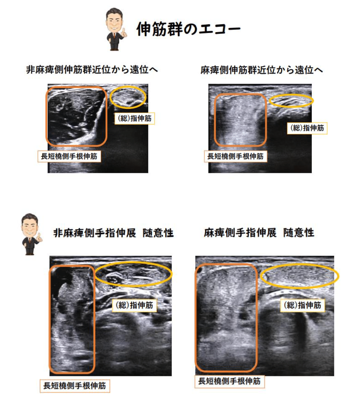 機能解剖と触診 MKPT研究会 機能解剖と触診 | MKPT研究会, 工藤 慎太郎 |本 | 通販 | Amazon