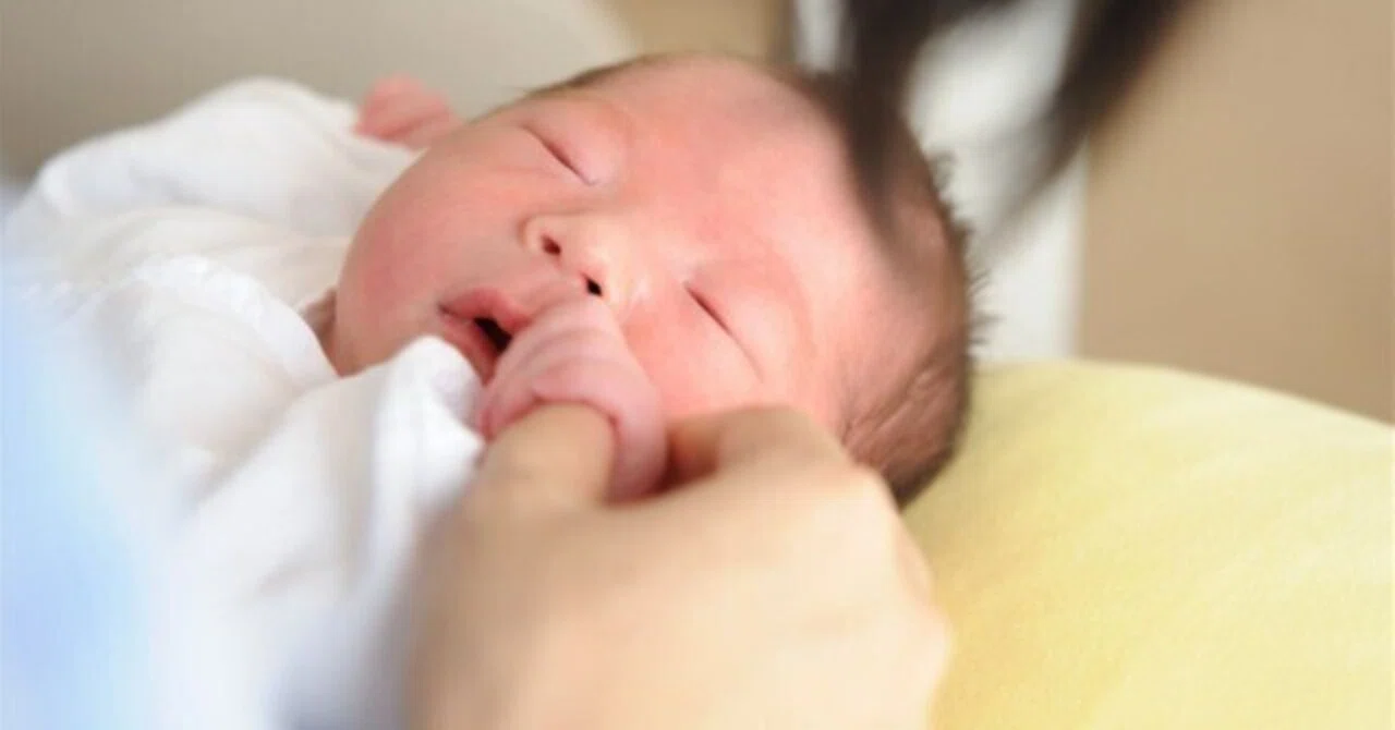 赤ちゃんの乳児湿疹 どうすれば治る 株式会社with Midwife Note