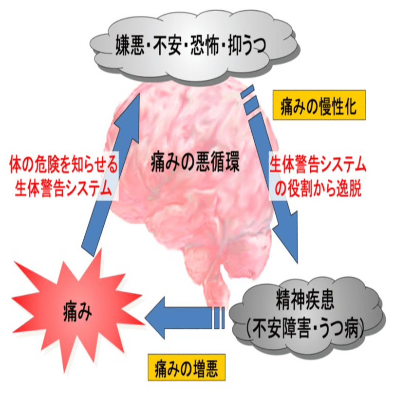 慢性疼痛-不安連鎖。脳内メカニズムが明らかに｜Super Human