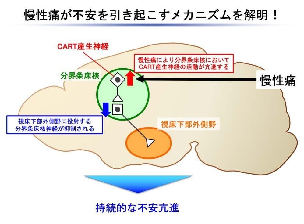 慢性疼痛-不安連鎖。脳内メカニズムが明らかに｜Super Human