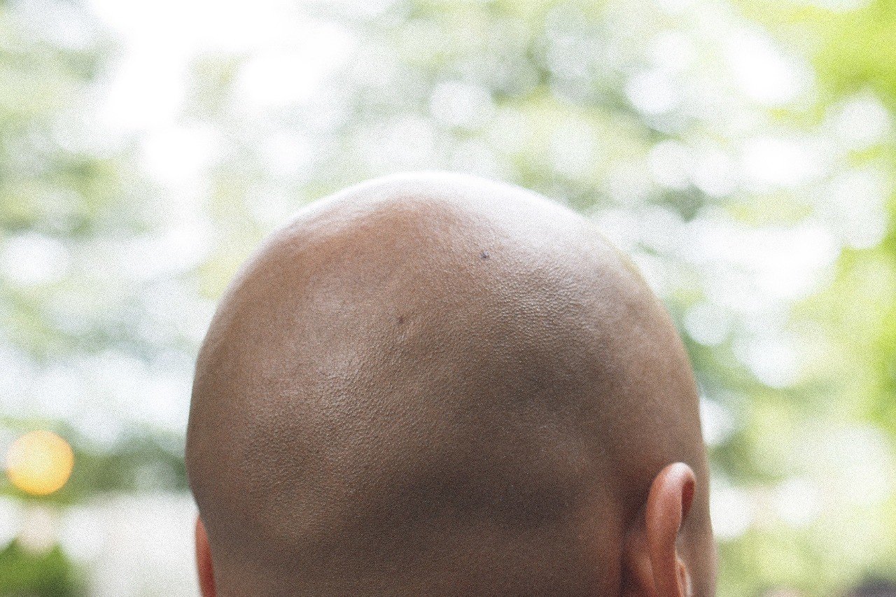 丸刈りがおれを強くする Akuzume Note