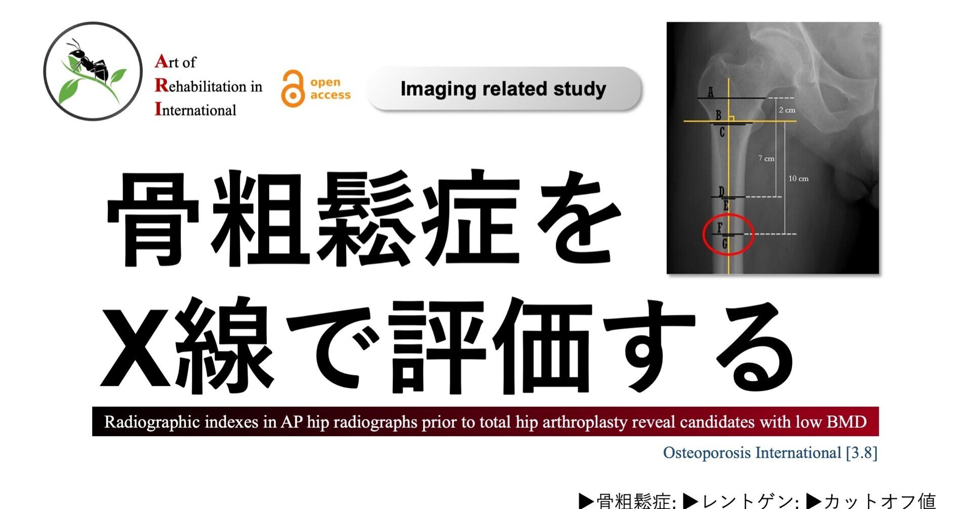 【公式】アクセサリーの激安通販 rectangle_large_type_2_20e86af 医学一般