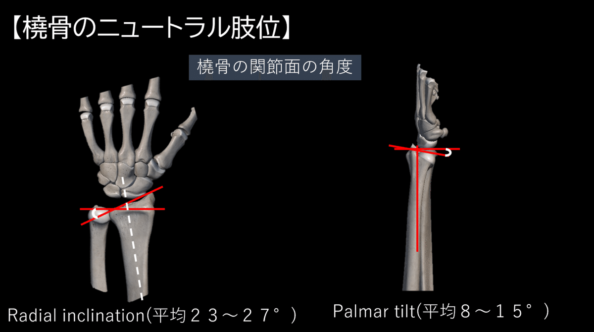 橈骨遠位端骨折のガイドラインとAO分類 - Genspark