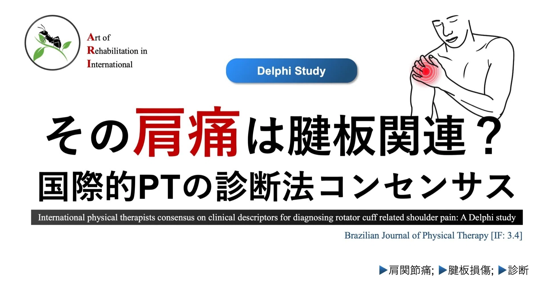 その肩痛は腱板関連？国際的理学療法士の診断法コンセンサス｜Super