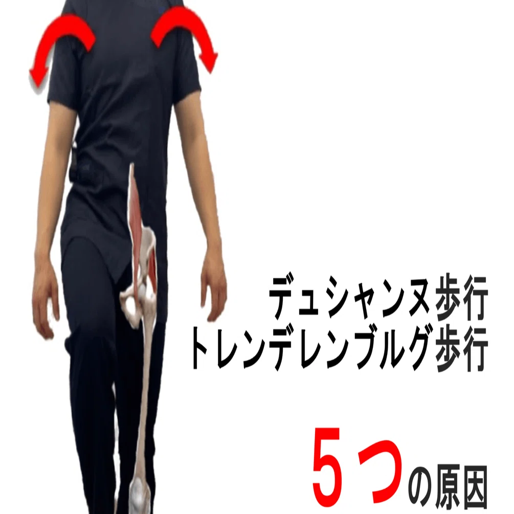 トレン デレン ブルグ 歩行